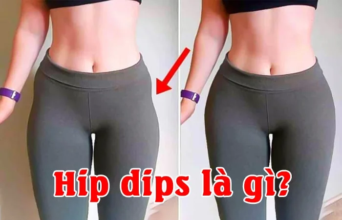 Hip dips là gì? Những bài tập giúp cải thiện Hip dips