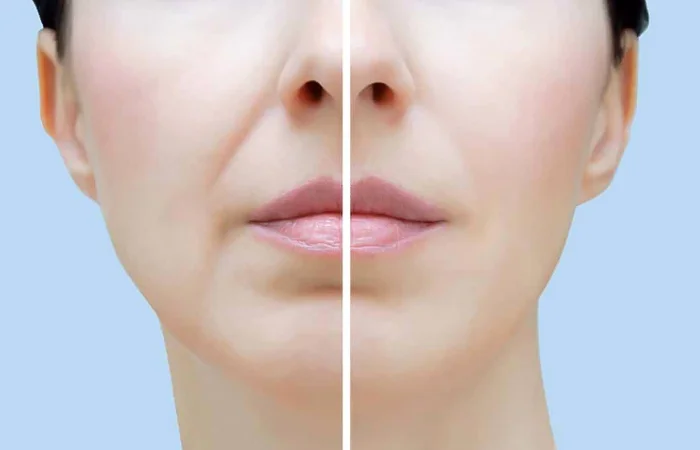 Râu rồng là gì? Râu rồng ảnh hưởng thế nào đến sắc đẹp?