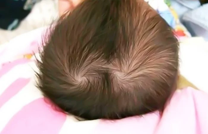 Trẻ có 2 xoáy, 3 xoáy, 4 xoáy tóc trên đầu có ý nghĩa gì