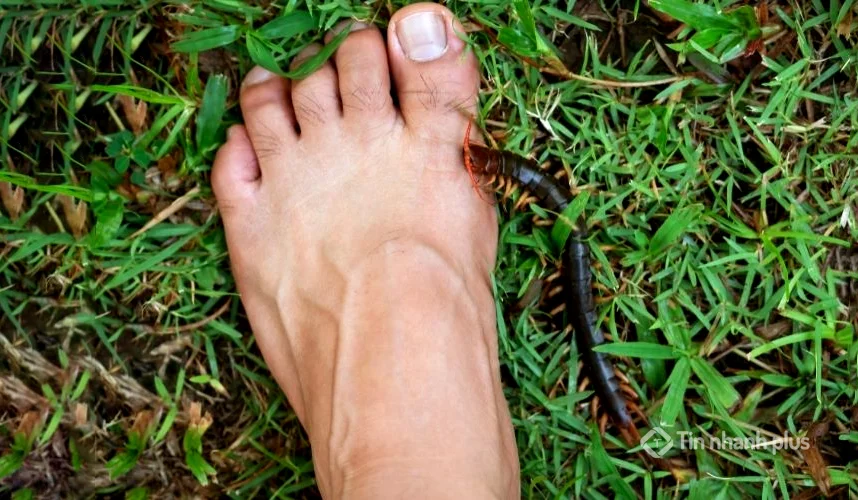 hình ảnh bị con rết cắn