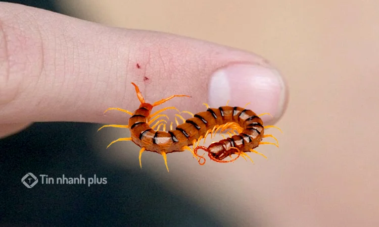 hình ảnh bị con rết cắn