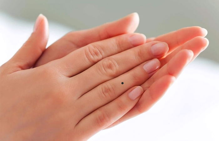 phụ nữ có nốt ruồi ở ngón áp út có ý nghĩa gì